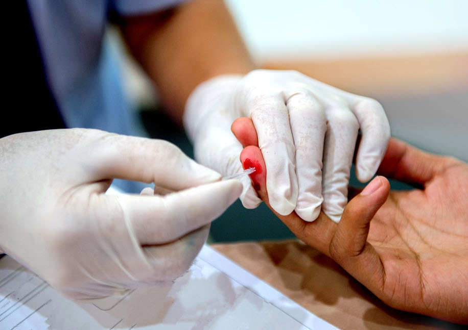 HIVTest